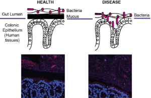 mucosa-and-bacteria-model